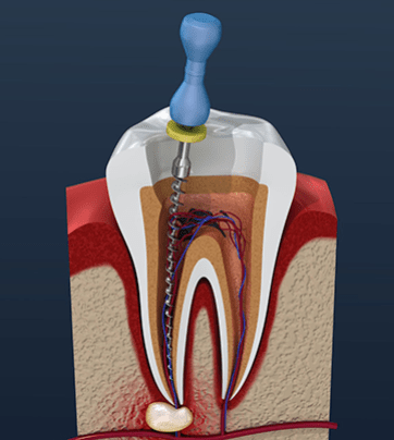 Treatment - All Saints Dental Care